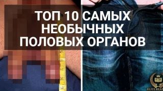 10 человек со необычными половыми органами